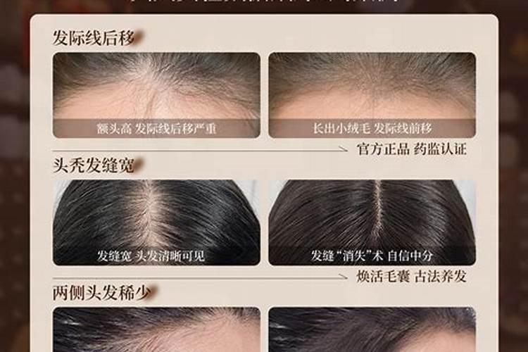 膨大素哪个品牌的最好