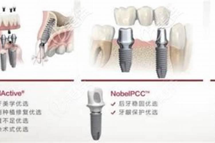 冲施肥哪个品牌好