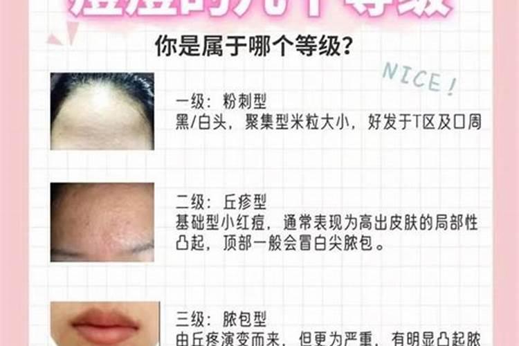 治疗榴莲果树腐烂病的药剂