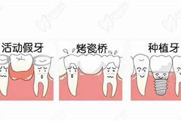 水溶肥不开袋放多长时间