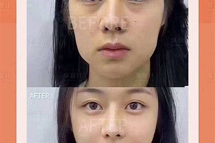 氮肥是什么肥