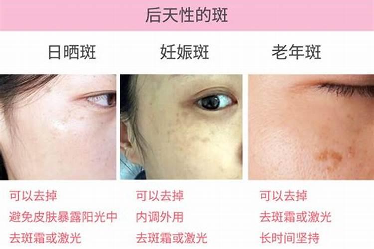 维生素e有什么作用与功效