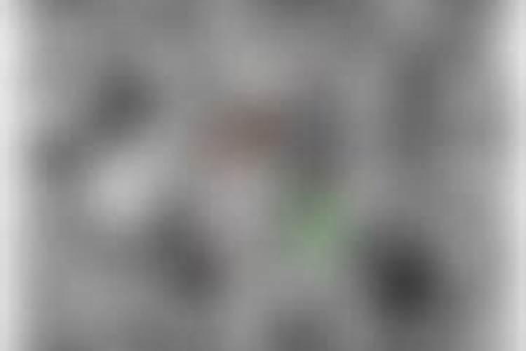 黄瓜叶子枯萎变黄是什么病怎样防治