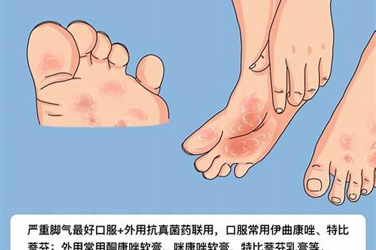 水垢的主要成分是啥
