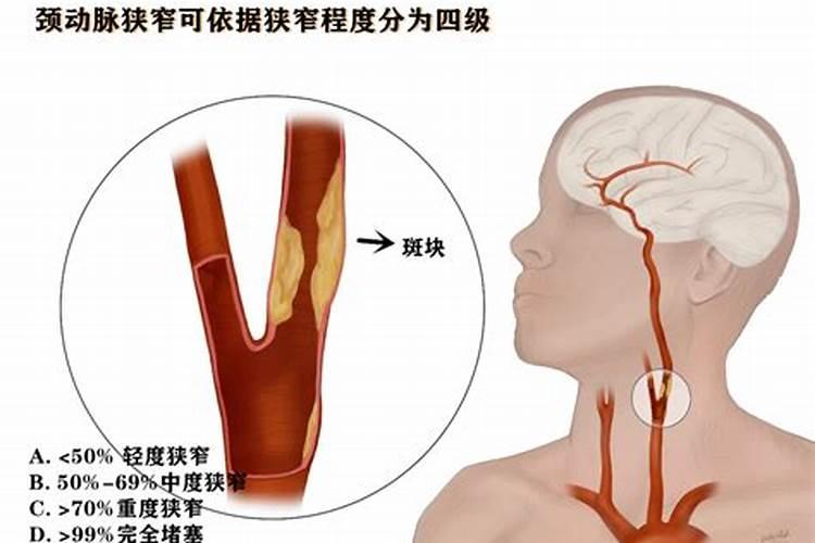 玉米叶片上出现了很多黄色斑块,是什么原因造成的？