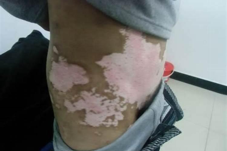 黄腐酸钾的使用方法
