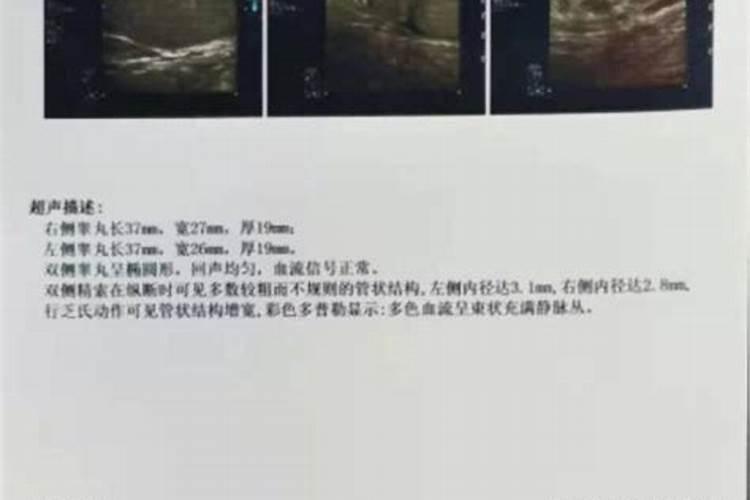 小麦在什么期间可打叶面肥？