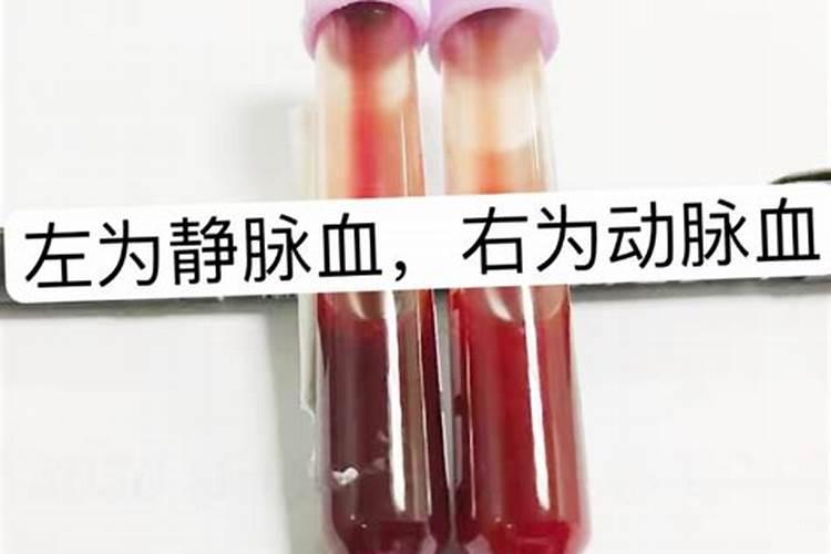 绿萝叶子发黄是什么原因 绿萝浇什么水长得最旺
